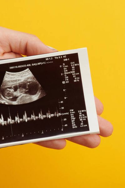 Violencia obstétrica